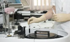 Technik analityk w rękawiczkach pobiera próbkę do analizy z automatycznego analizatora laboratoryjnego.