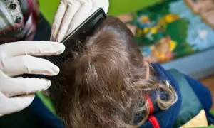 Pielęgniarka szkolna a wszawica: Co musisz wiedzieć o prawach rodzica?