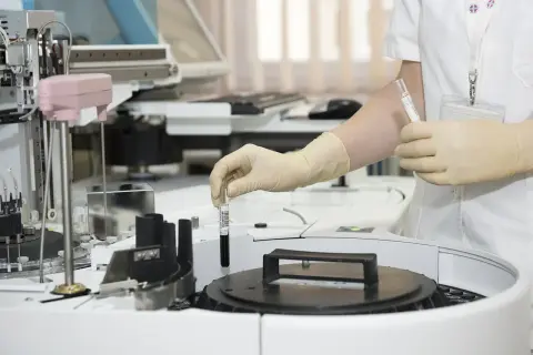 Technik analityk w rękawiczkach pobiera próbkę do analizy z automatycznego analizatora laboratoryjnego.