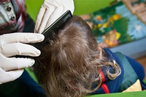 Pielęgniarka szkolna a wszawica: Co musisz wiedzieć o prawach rodzica?