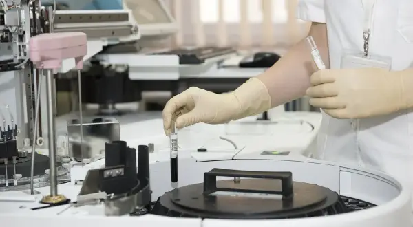 Technik analityk w rękawiczkach pobiera próbkę do analizy z automatycznego analizatora laboratoryjnego.
